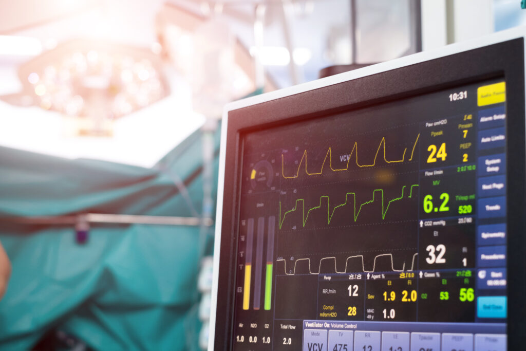 Capnography for Anesthesia
