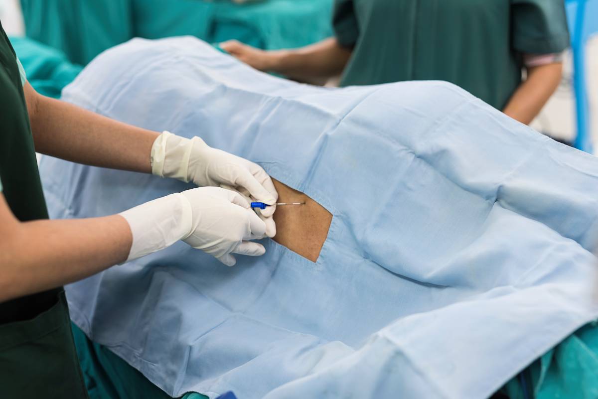 Epidural Catheters for Non-Obstetric Procedures