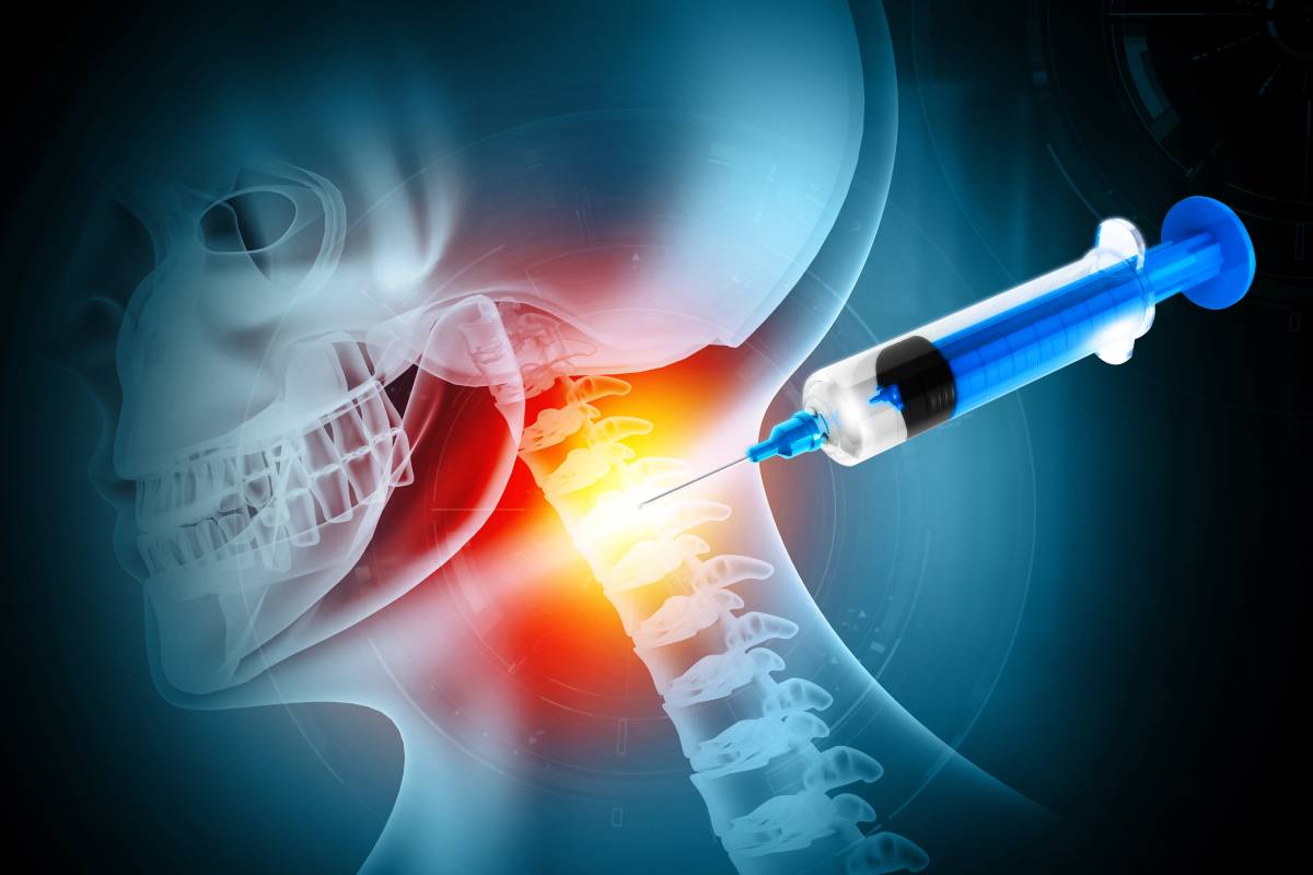 Neuraxial Anesthesia in the Cervical Spine